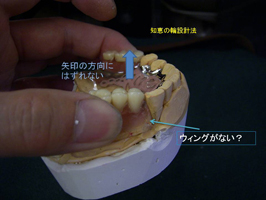知恵の輪デンチャー
